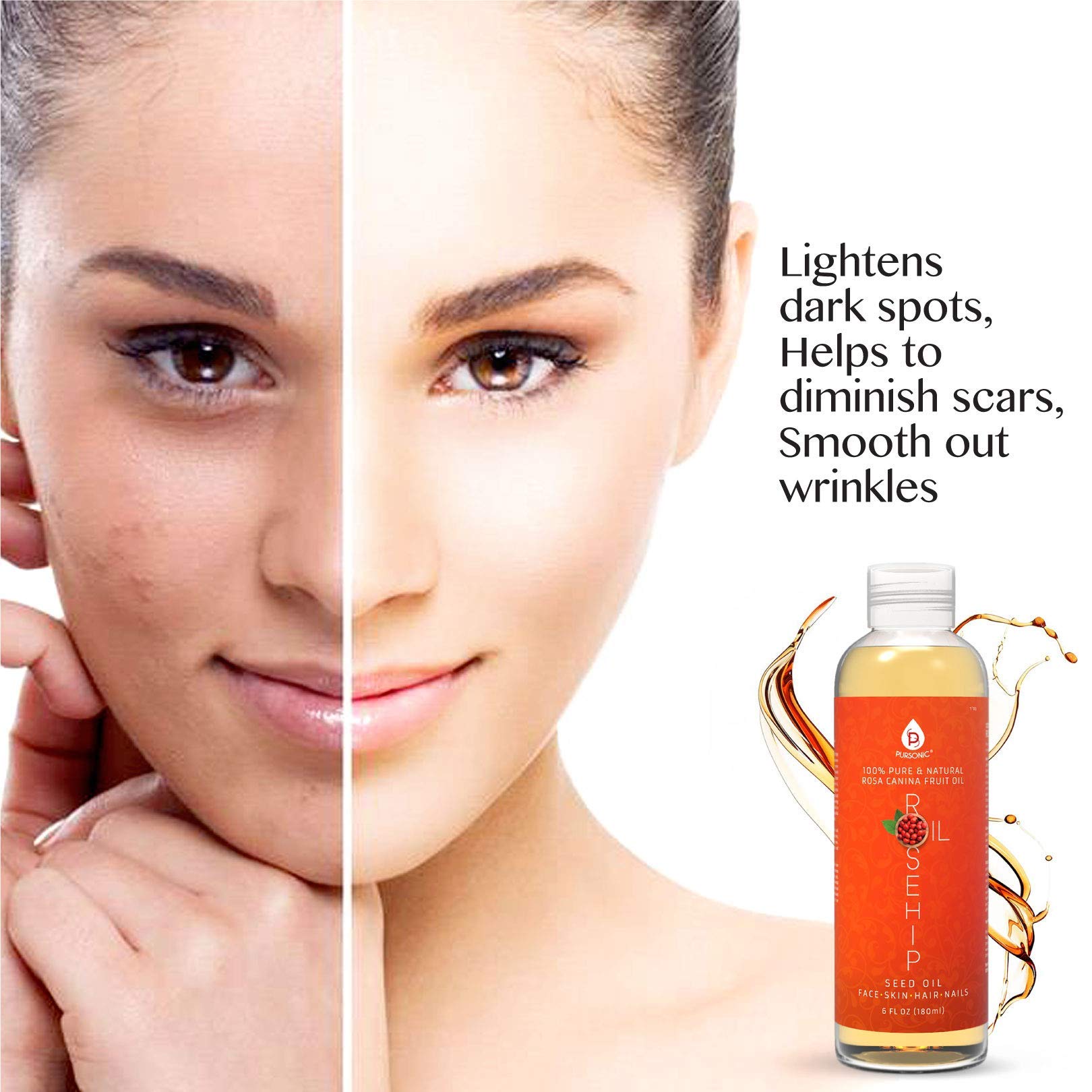 Pursonic 100 percent pure rosehip fruit oil size comparison showing the generous six fluid ounce bottle capacity