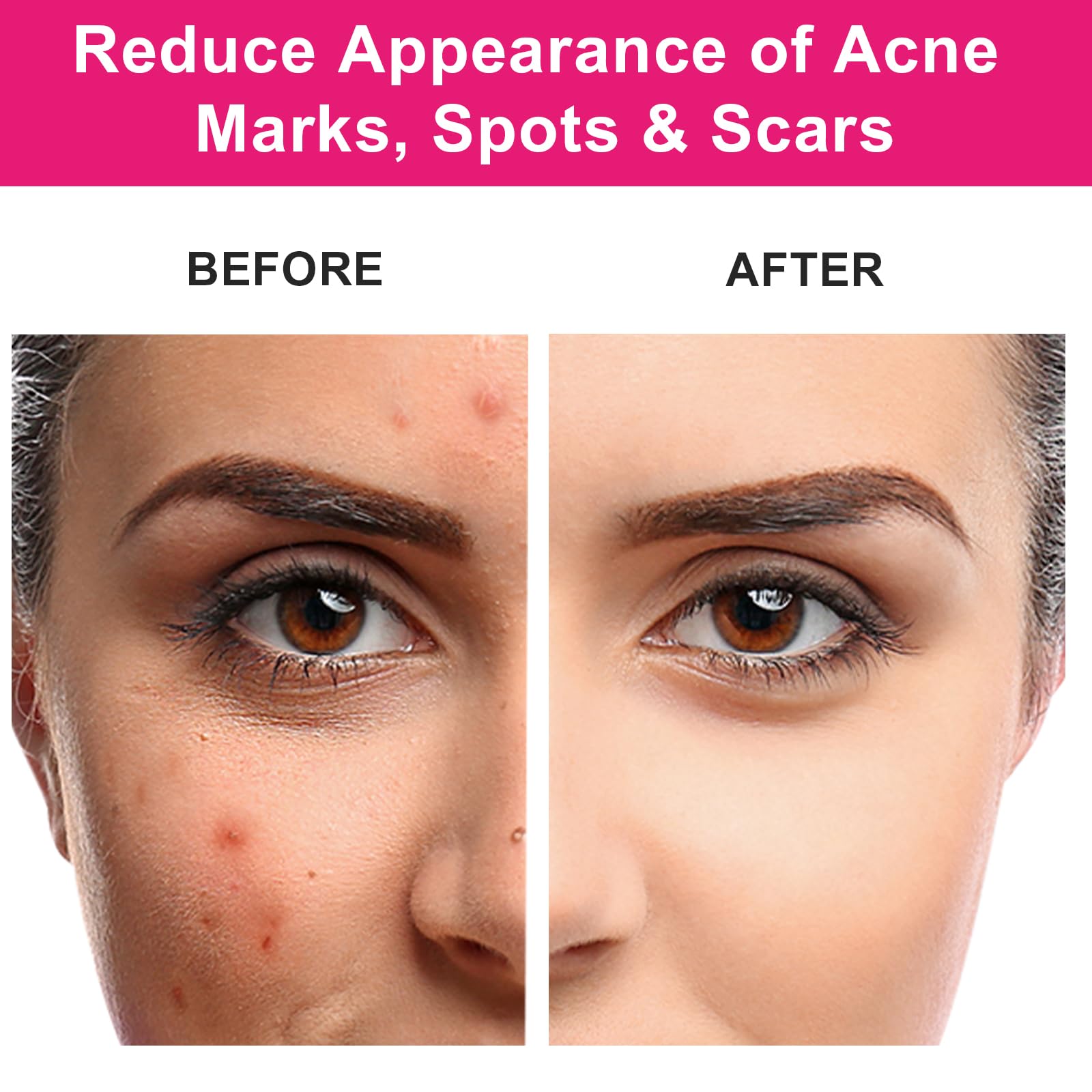 Lightweight botanical rosehip seed oil for face and hair hydration