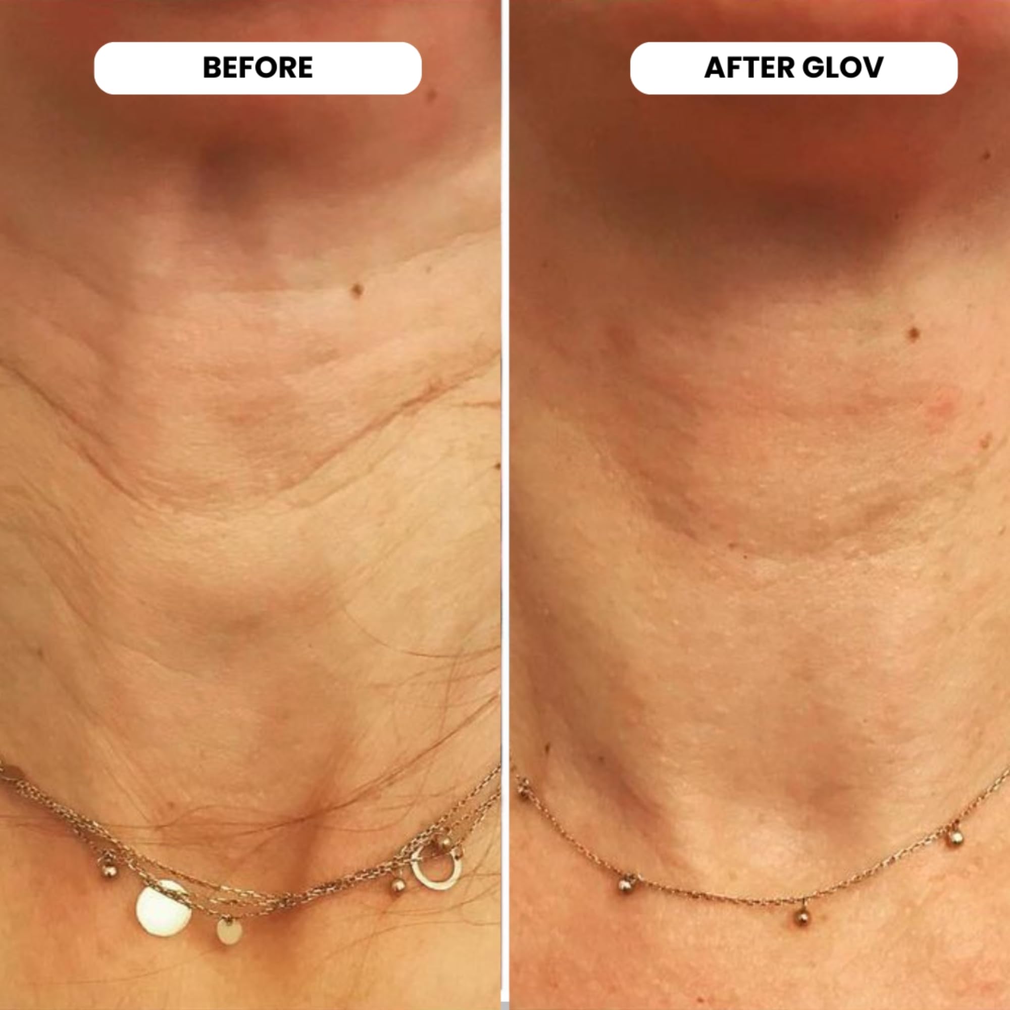 At home skincare routine using Glov Beauty microinfusion kit for lips and face