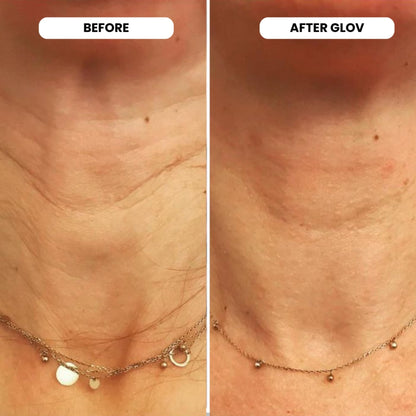 At home skincare routine using Glov Beauty microinfusion kit for lips and face