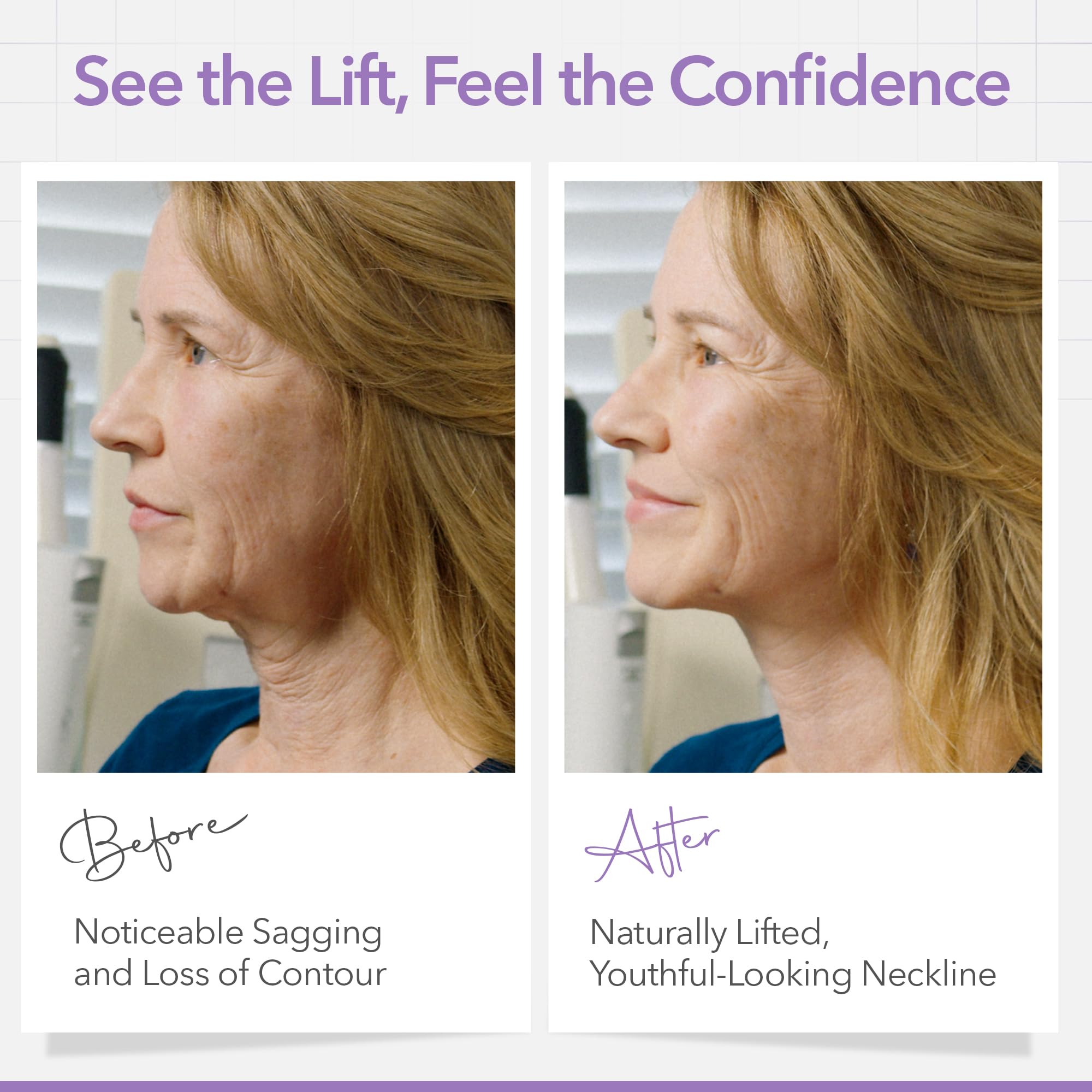 Waterproof and sweat resistant face lifting tape showing long lasting hold before and after results