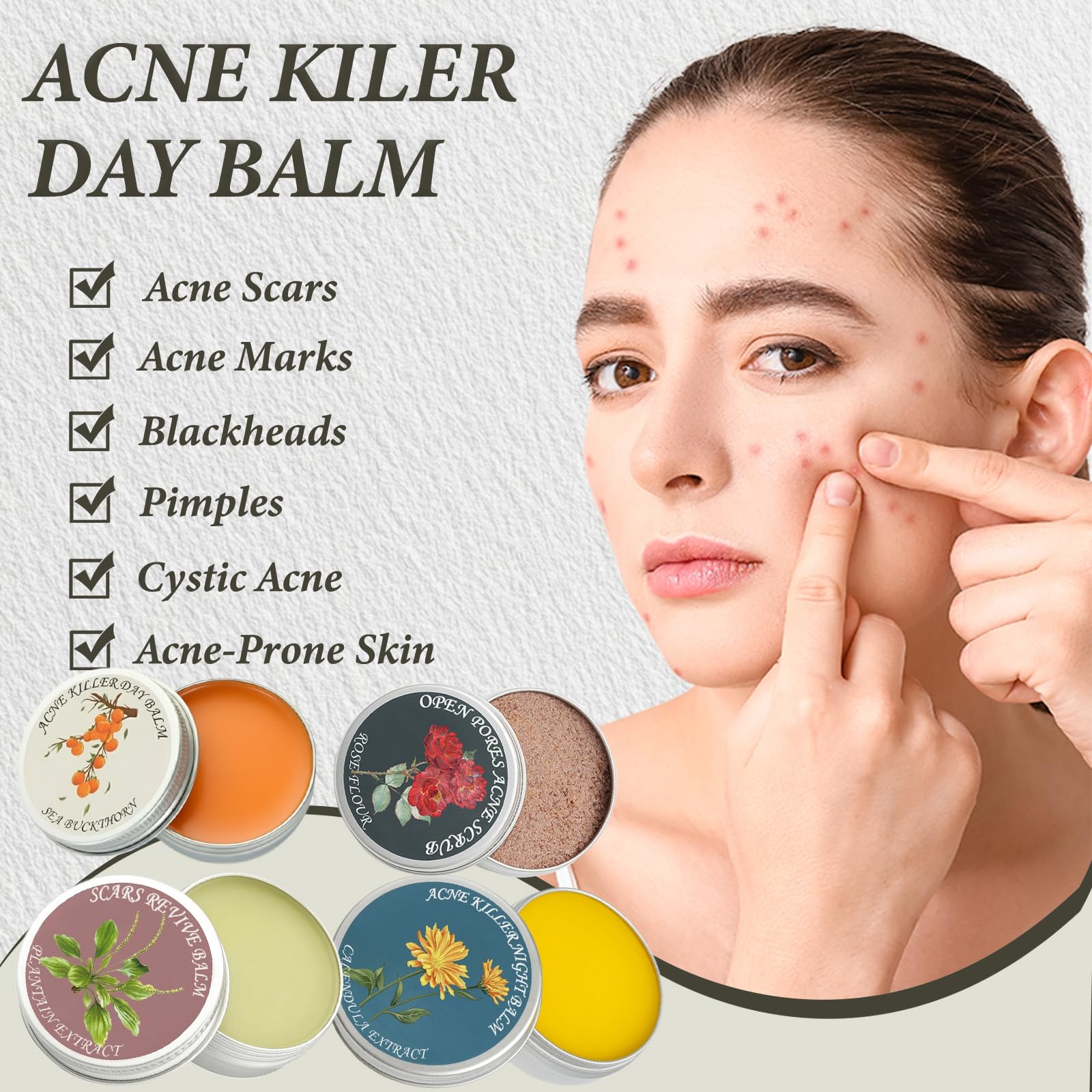 SDXJIOGE Acne Killer Day Balm with sea buckthorn targeting facial redness and active breakouts