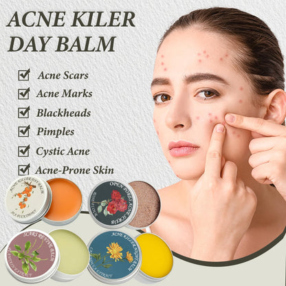 SDXJIOGE Acne Killer Day Balm with sea buckthorn targeting facial redness and active breakouts
