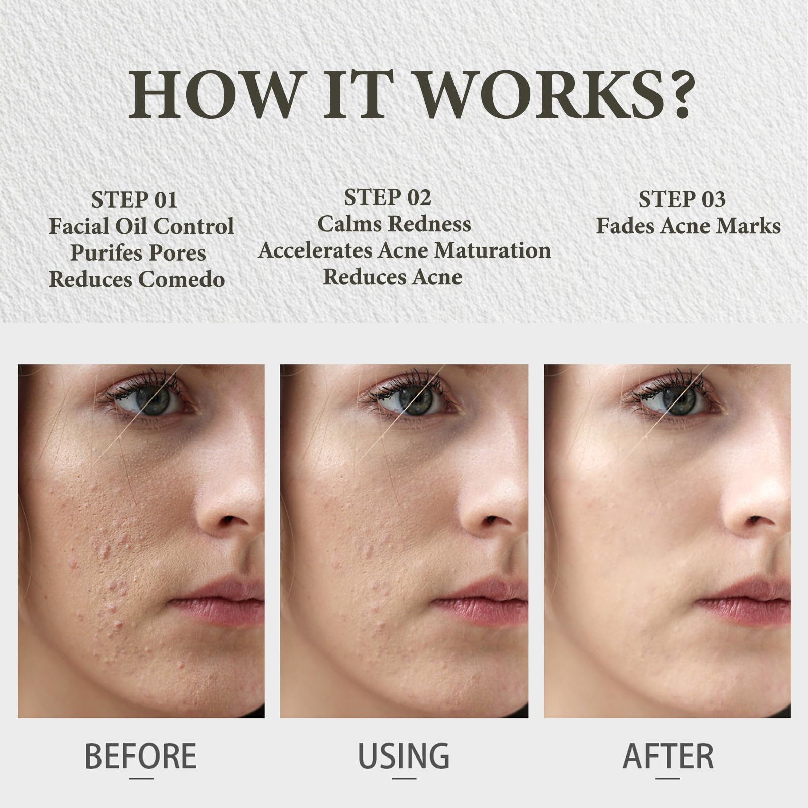 SDXJIOGE natural botanical acne treatment kit texture showing concentrated waterless balm consistency