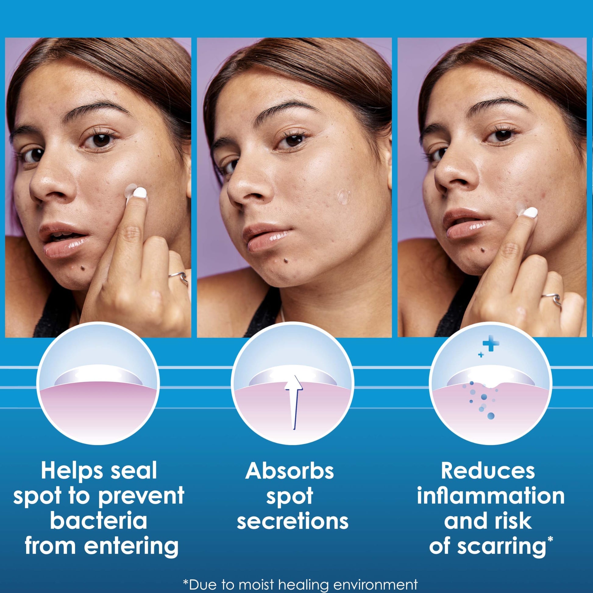 Clearasil acne patch application tutorial on face showing near invisible daytime wear