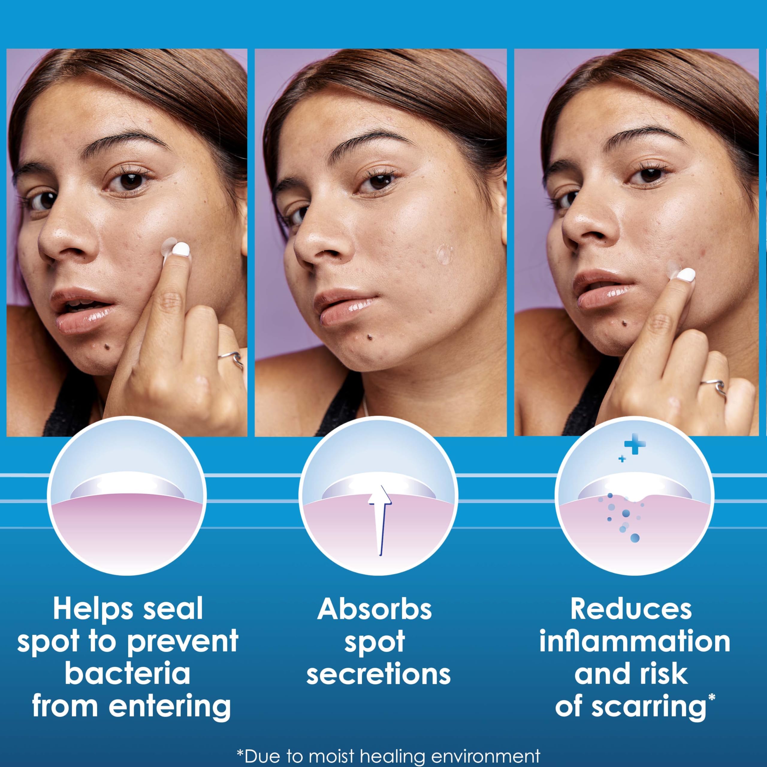 Clearasil acne patch application tutorial on face showing near invisible daytime wear