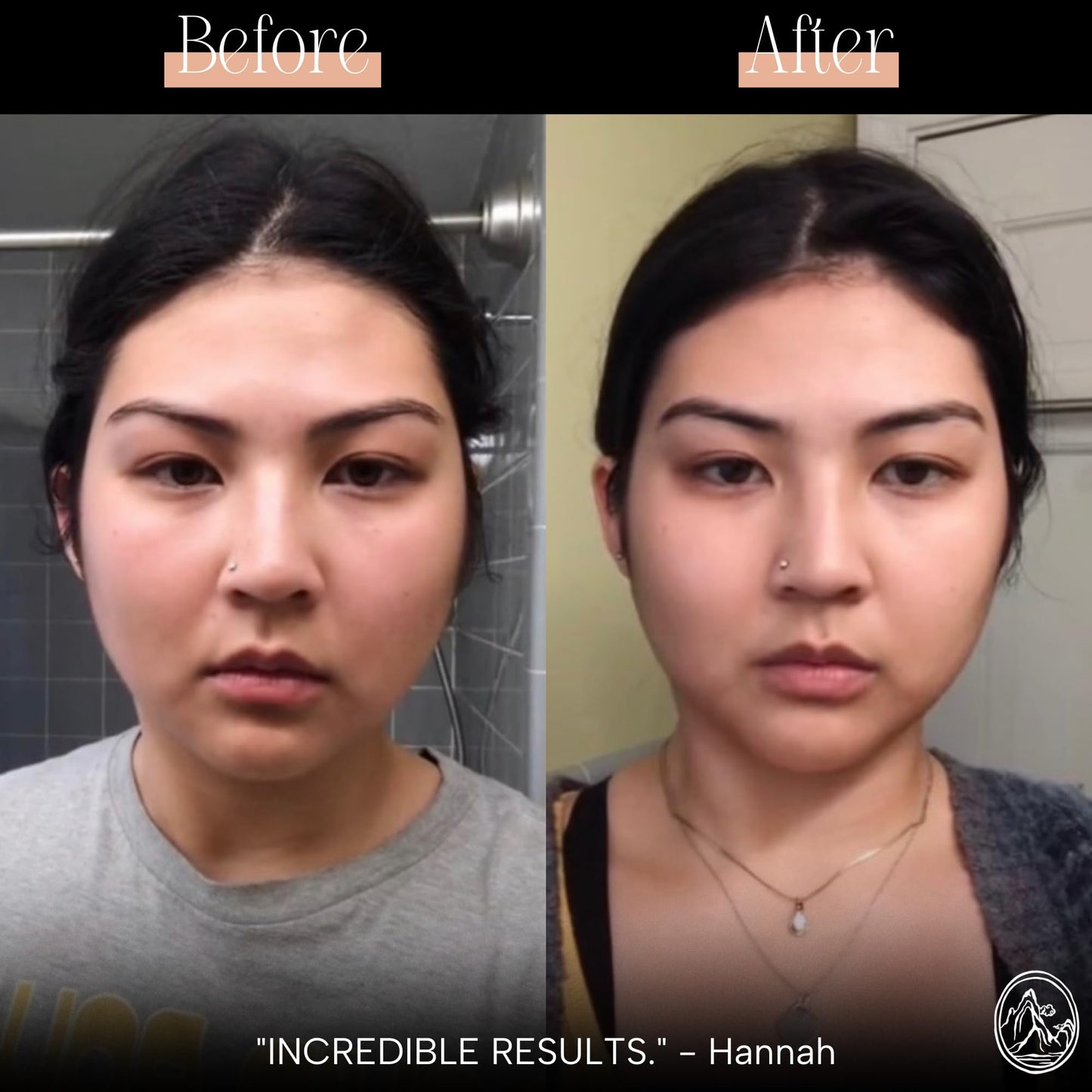 Mount Lai facial massager angle view illustrating smooth contoured edges