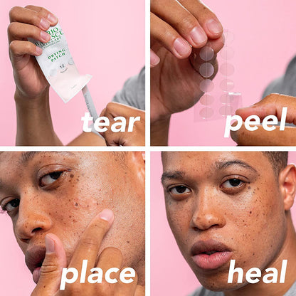 Mario Badescu blemish kit unboxing view showcasing the one fluid ounce bottle and twelve adhesive patches.