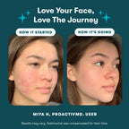 Proactiv Ultra-Hydrating Moisturizer container bottle view