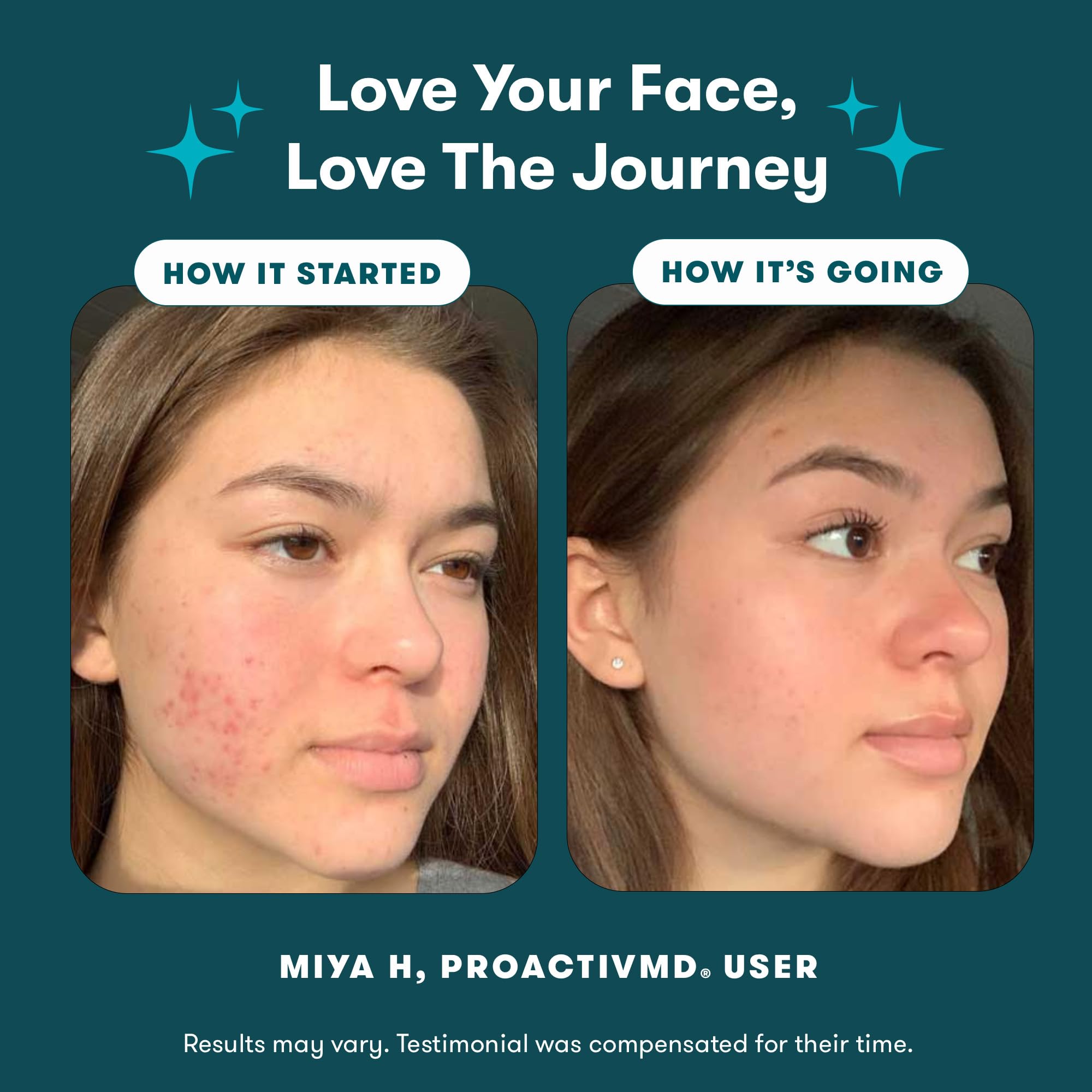 Proactiv MD Ultra-Hydrating Moisturizer for restoring skin moisture barrier