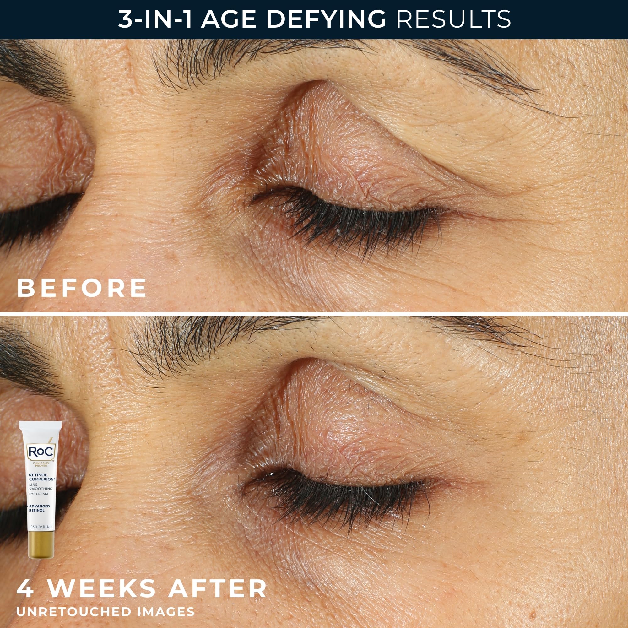 Authentic USA imported RoC Retinol Duo kit showcasing the dual action treatment for facial lines and under eye puffiness