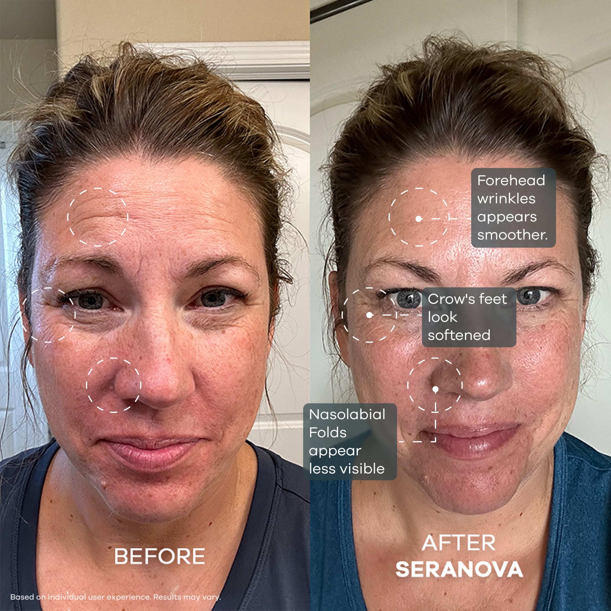 Seranova smooth skin facial serum vials included in the one month supply pack.