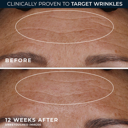 Texture shot of the lightweight non-comedogenic RoC retinol cream for overnight facial rejuvenation