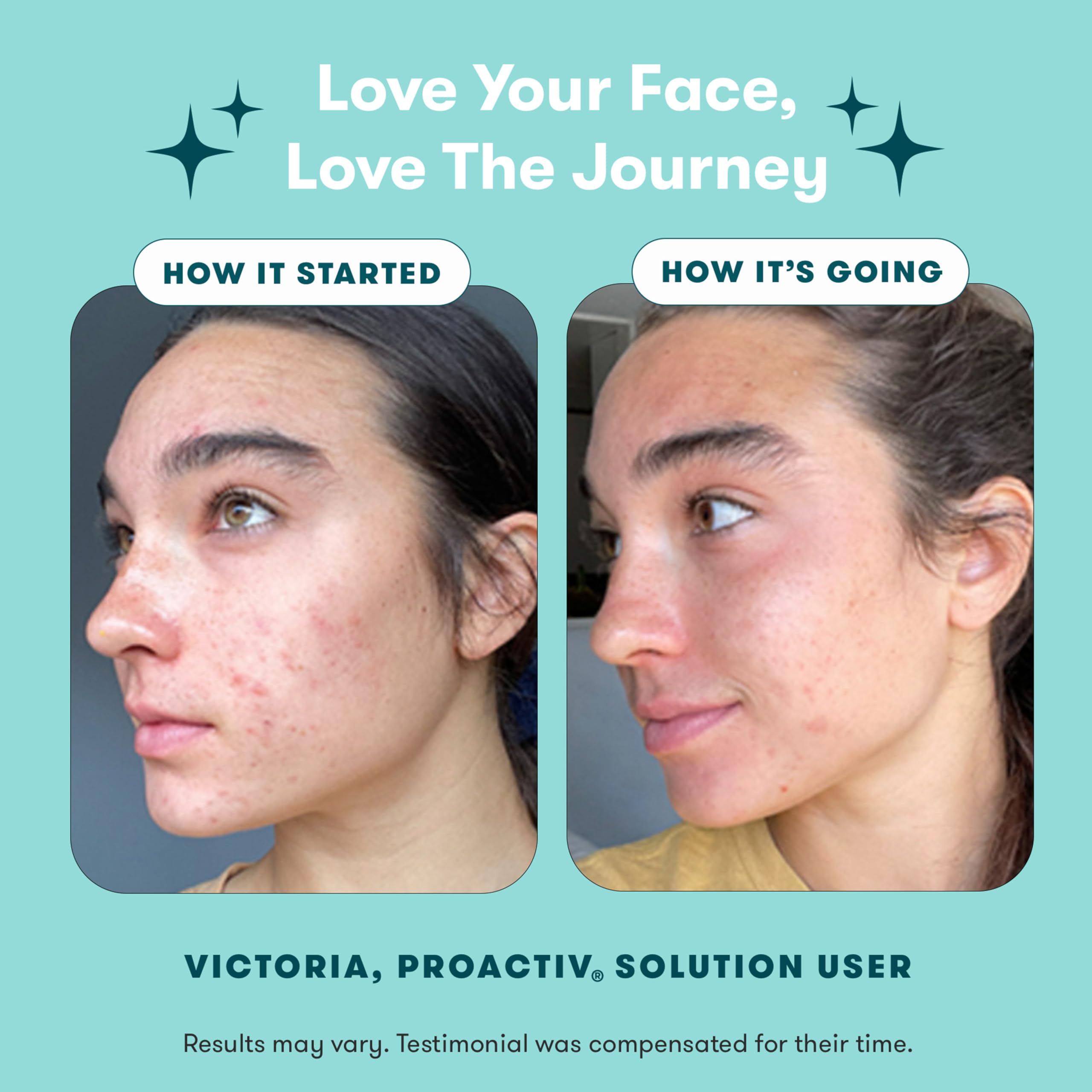 Proactiv Revitalizing Toner bottle displaying the clarifying formula for acne-prone skin.