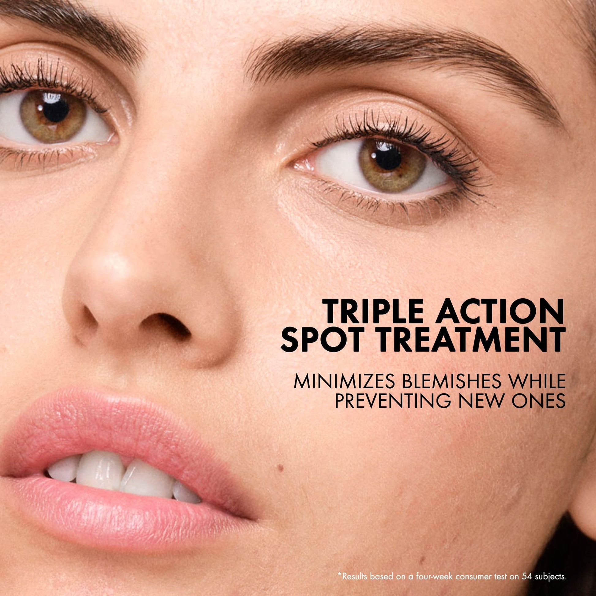 Vichy sulfur acne spot treatment tube with precision applicator tip