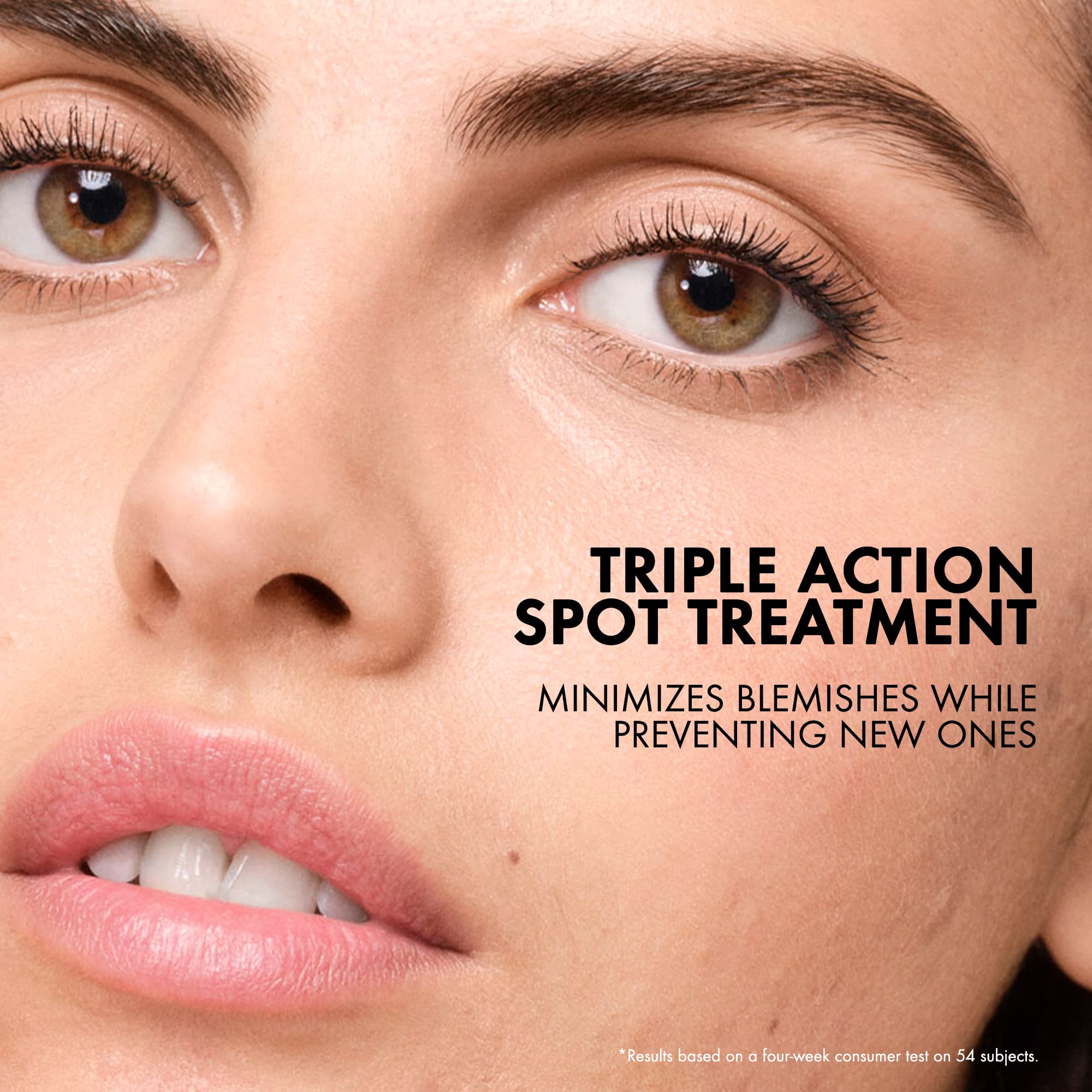 Vichy sulfur acne spot treatment tube with precision applicator tip