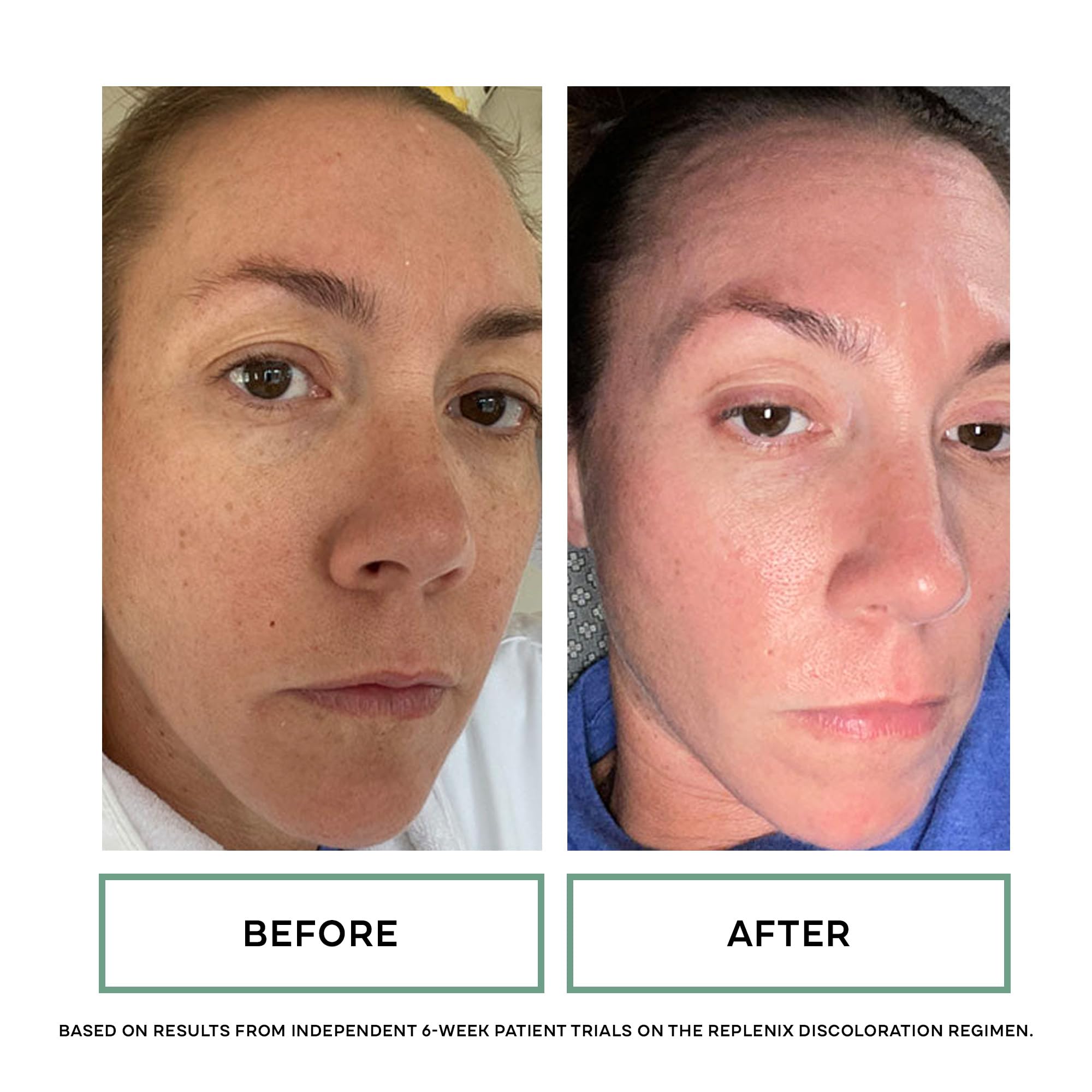 Replenix Glycolix Elite treatment pads container highlighting pore minimization and texture smoothing benefits