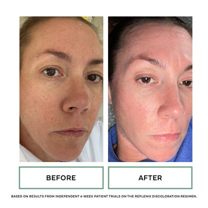 Replenix Glycolix Elite treatment pads container highlighting pore minimization and texture smoothing benefits