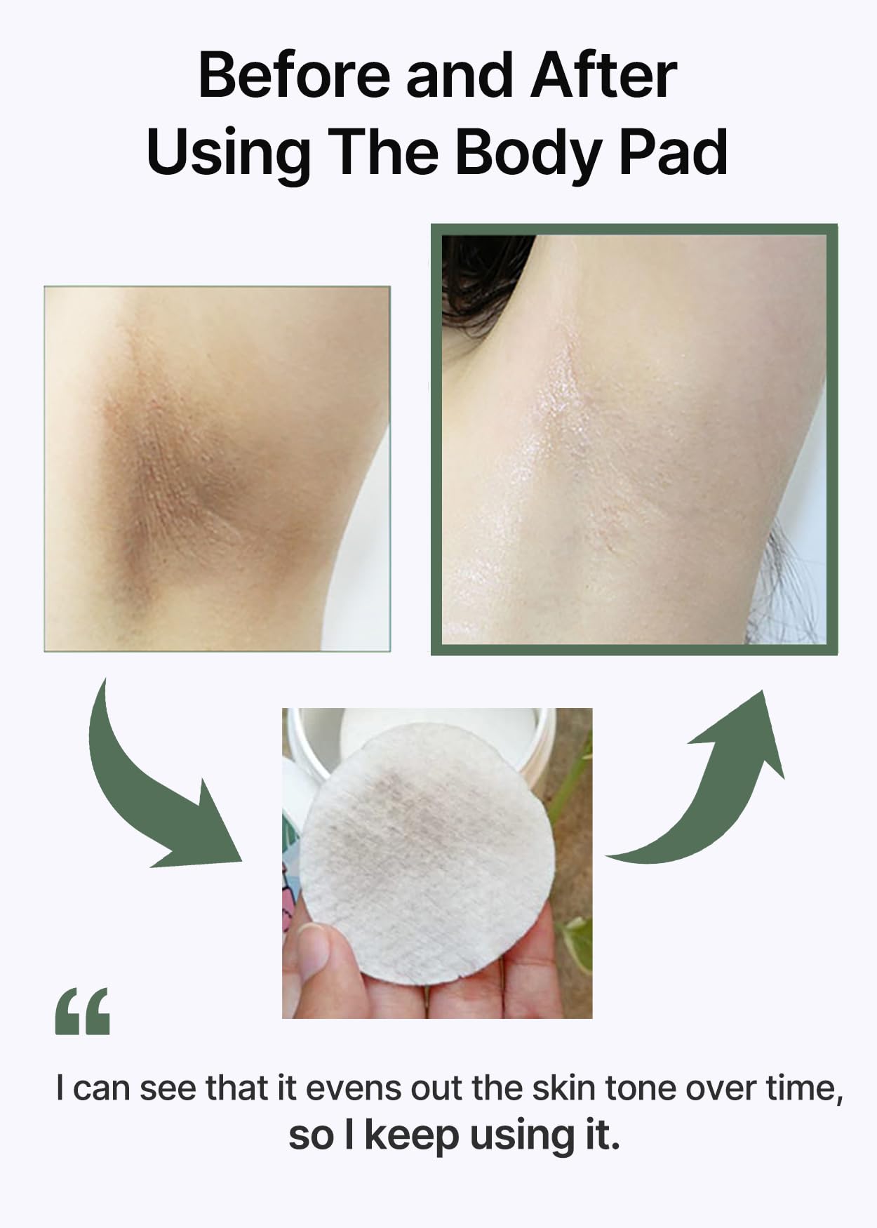 Before and after visualization mockup of smooth underarms using Celimax body brightening pads