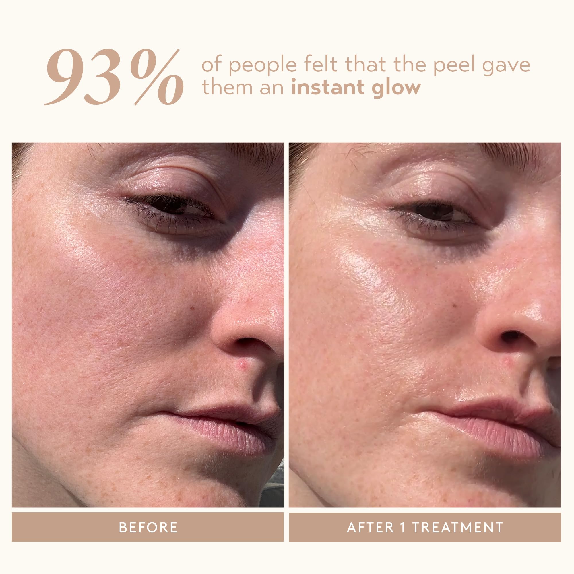 The complete Shani Darden two step resurfacing kit packaging including the exfoliating acids.