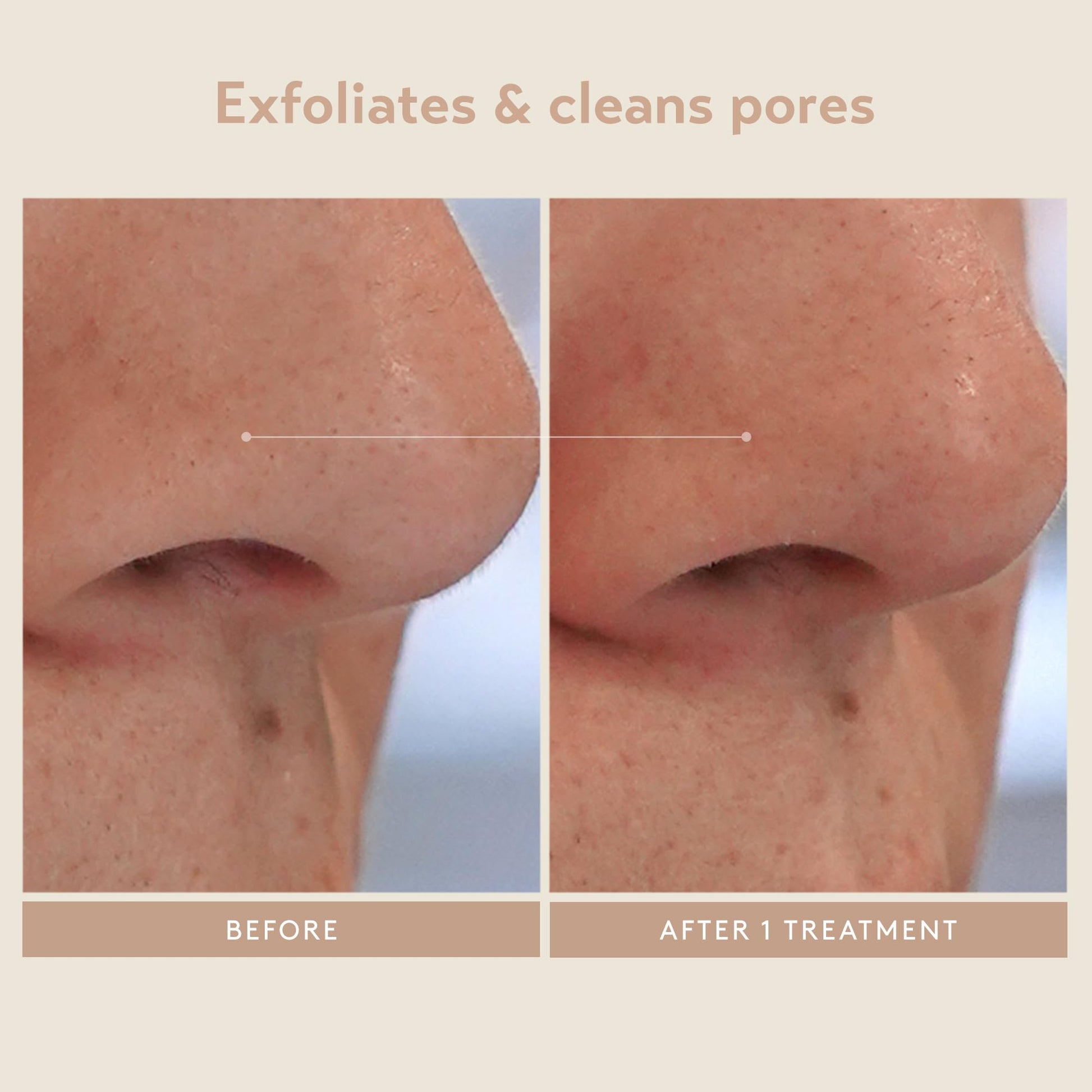 Close up of the texture of the step two kaolin clay neutralizing facial mask.