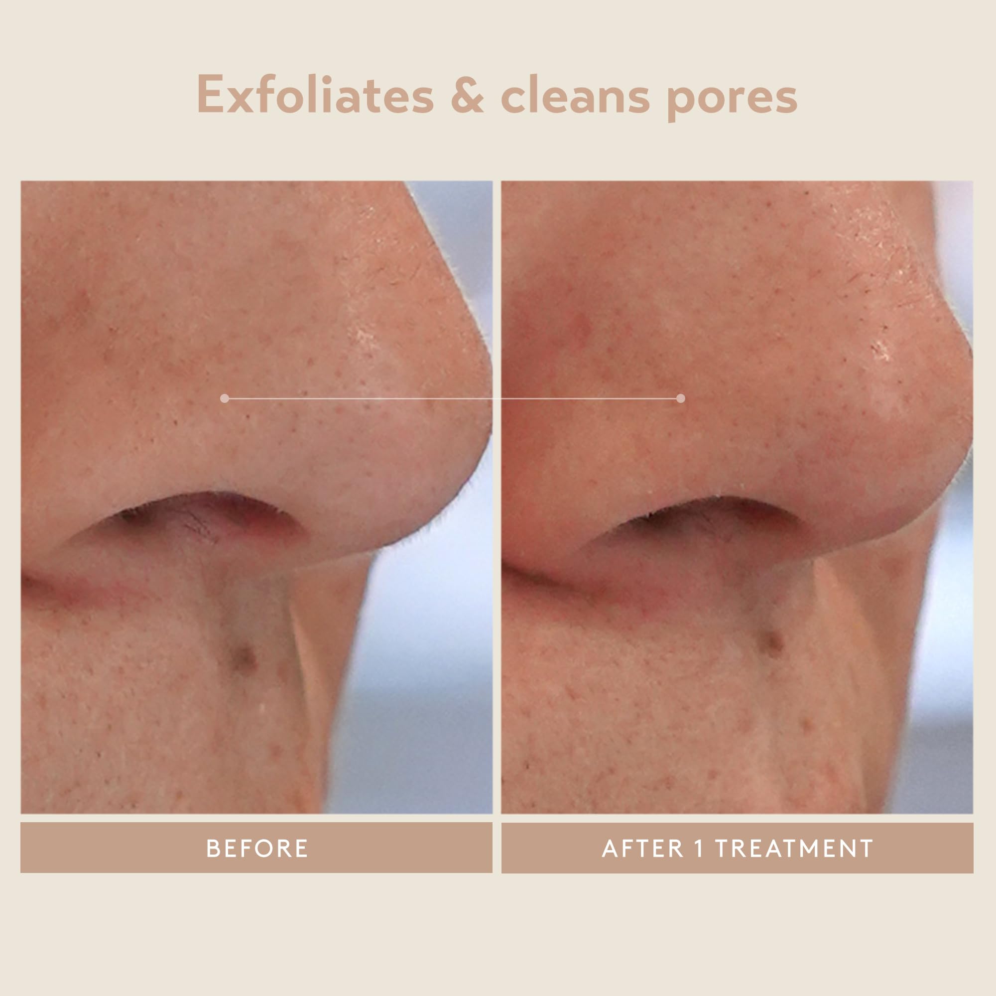 Close up of the texture of the step two kaolin clay neutralizing facial mask.