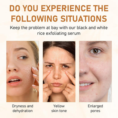Application of Vincofoo moisturizing rice exfoliator liquid on face