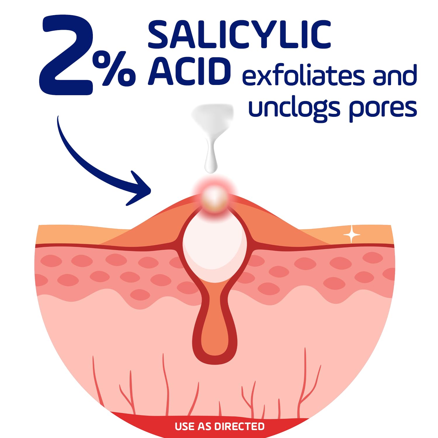 Texture detail of the non-sticky Asepxia fast acting acne cream for adults and teenagers.