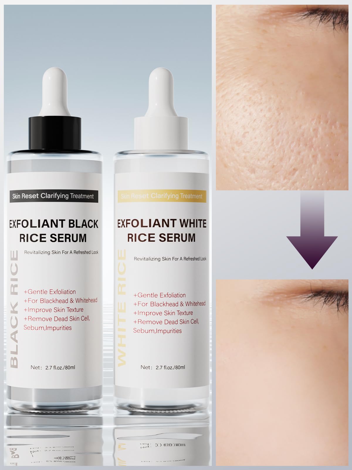 The complete PIVETOS face exfoliant skin shot set displayed clearly against a clean skincare-themed background.