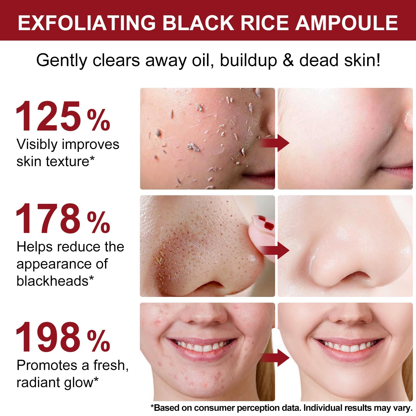 OEDPMFYL Korean skincare dual rice exfoliant set packaging details