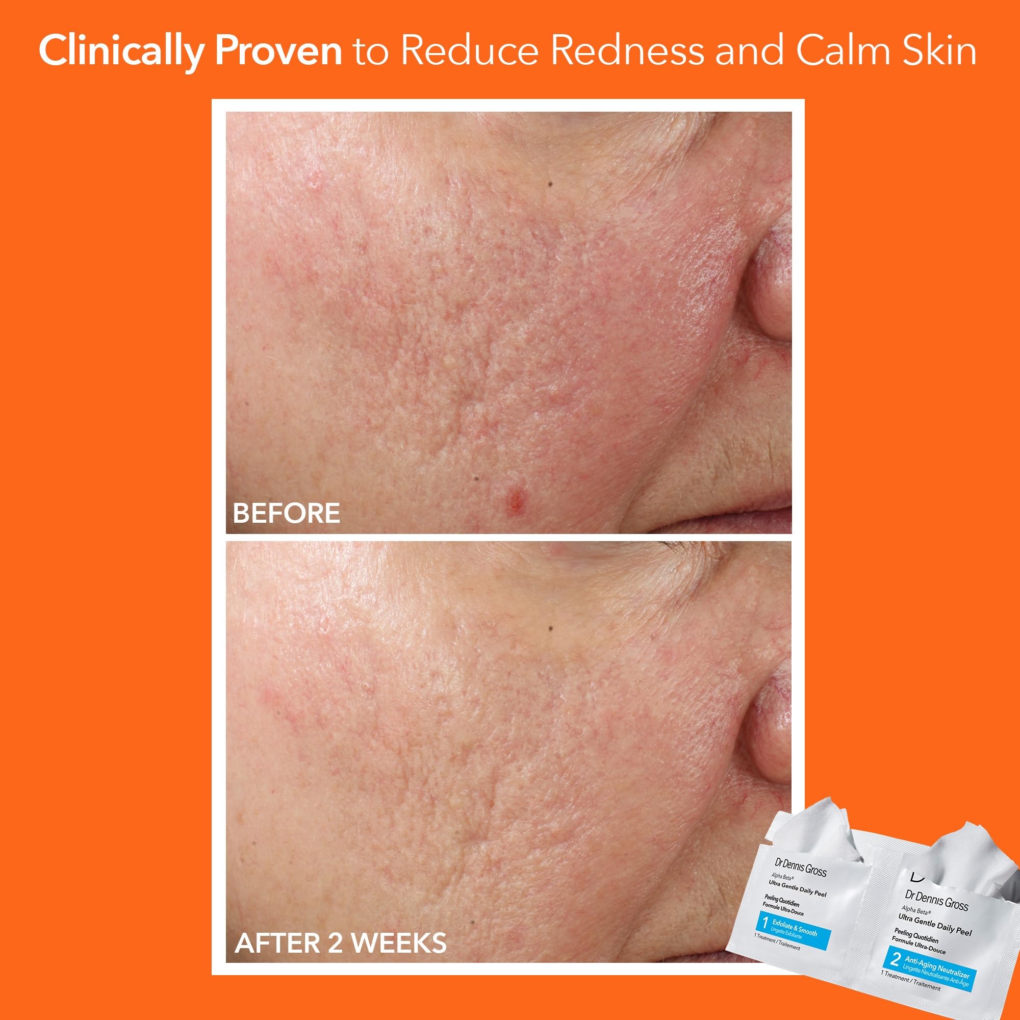 Dr. Dennis Gross Ultra Gentle Daily Peel packaging showing 30 treatments for dehydrated skin