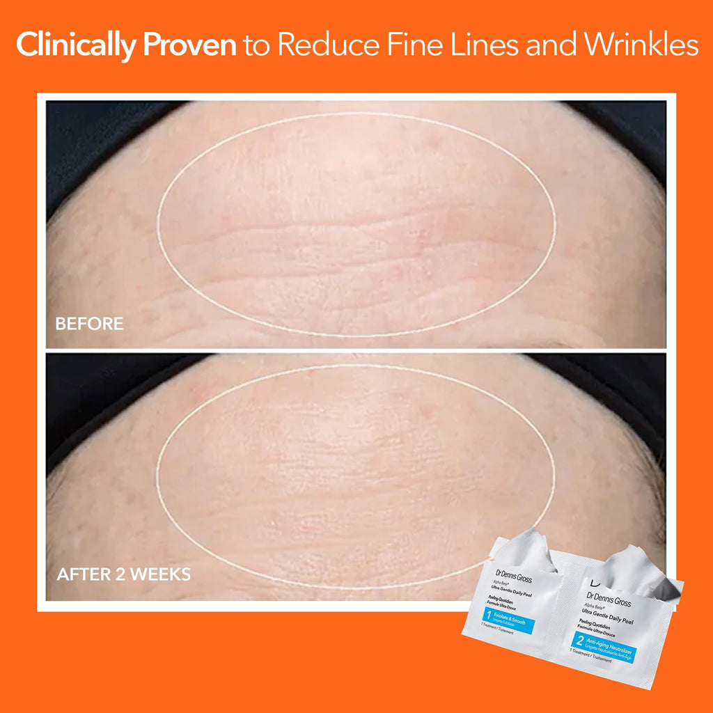 Dr Dennis Gross professional grade at home chemical exfoliant box and sample pads