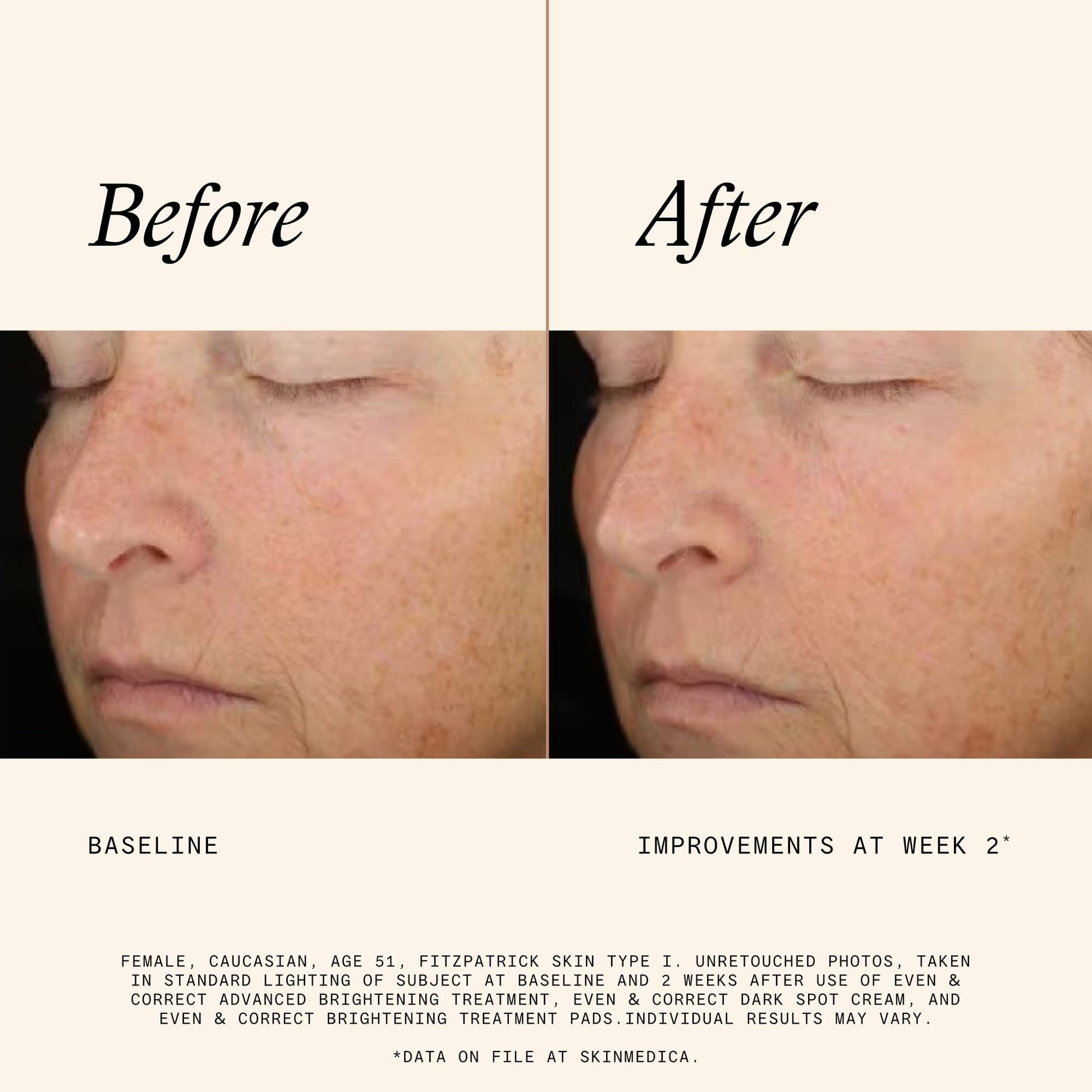 SkinMedica Even and Correct dark spot correcting pads jar sitting on a modern vanity setup