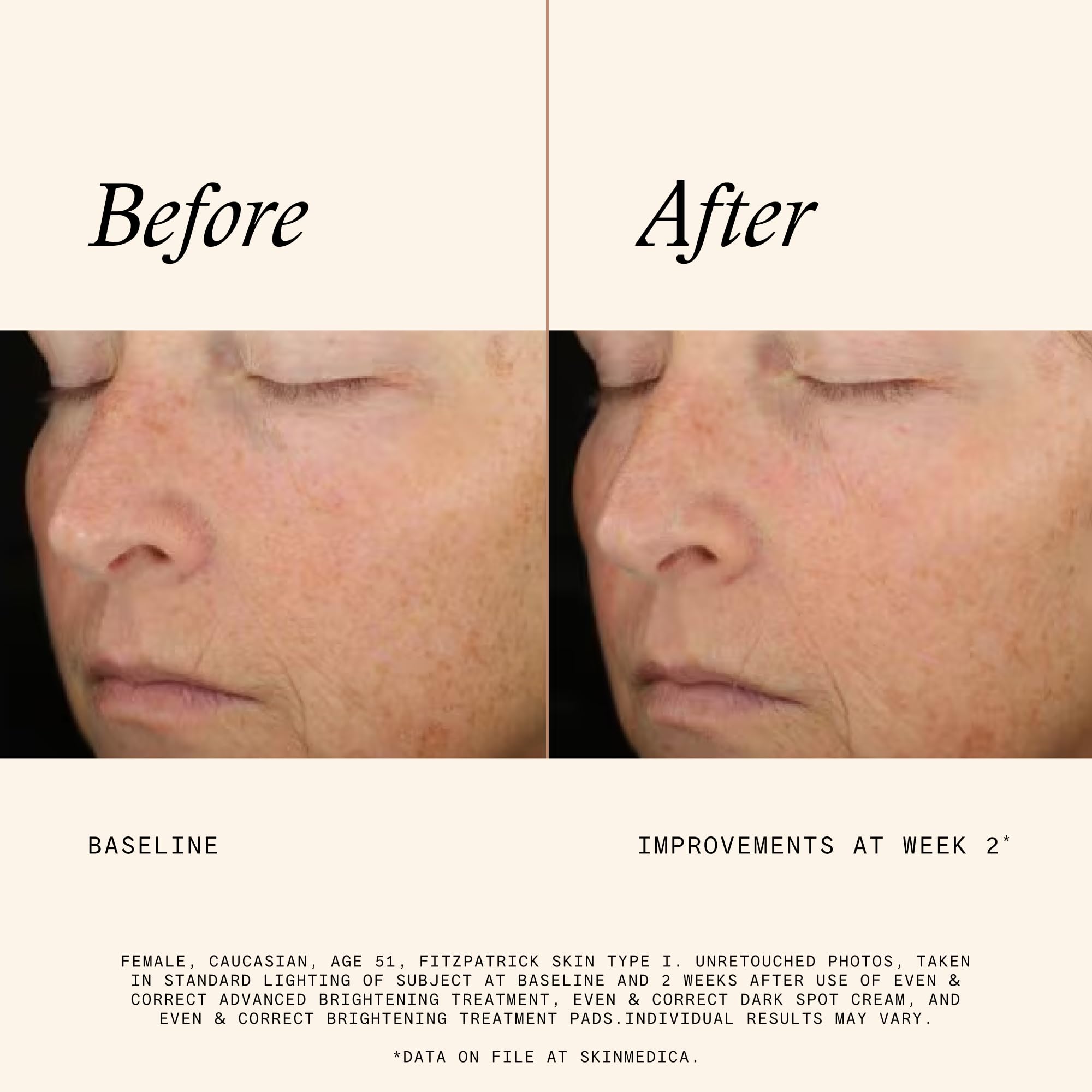 SkinMedica Even and Correct dark spot correcting pads jar sitting on a modern vanity setup