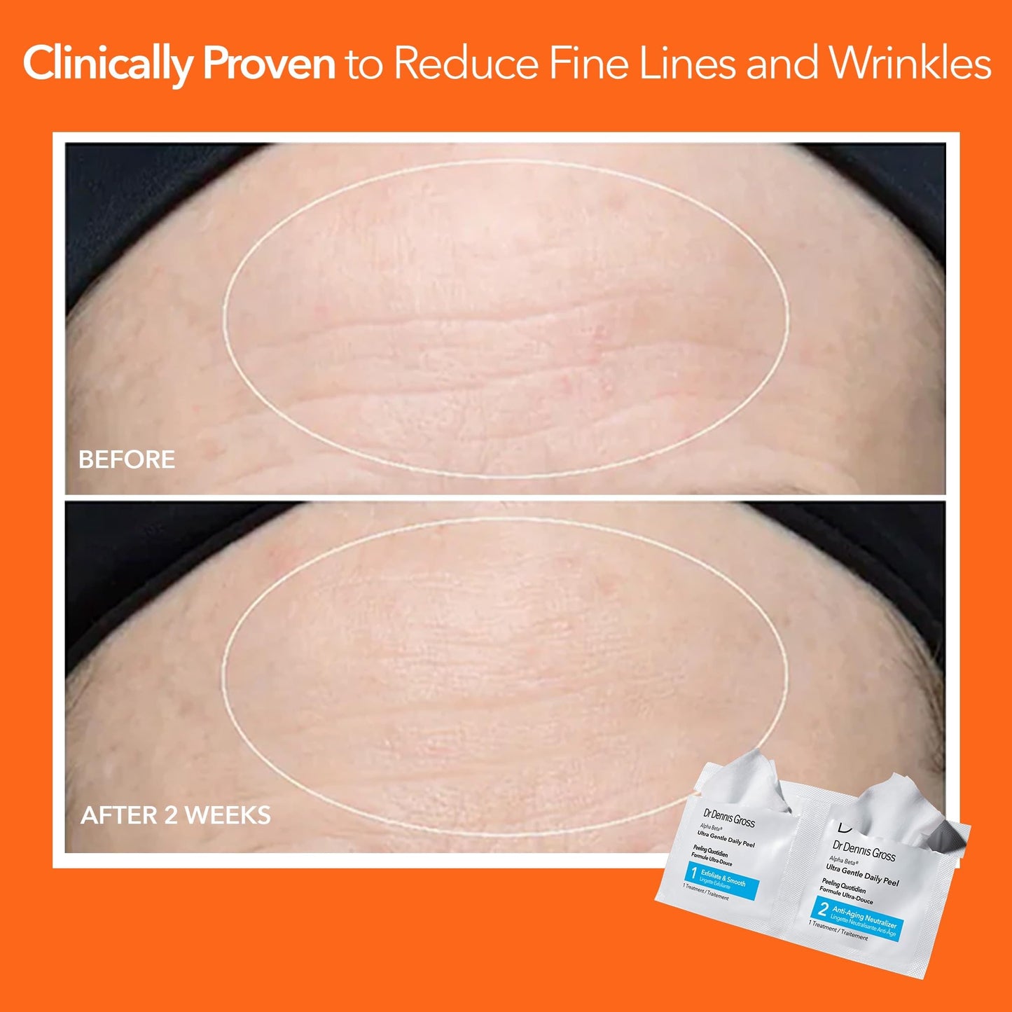 Dr. Dennis Gross dermatologist developed gentle peel pads for fine lines and pores