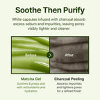 Centellian 24 Madeca Matcha Toning Peeling Gel tube cap open