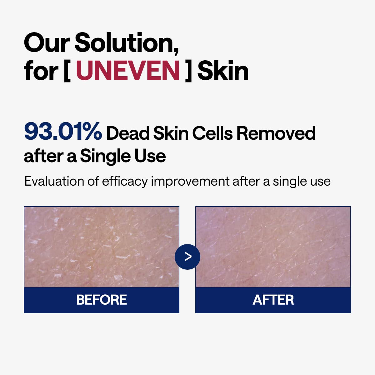 Model applying the square LHA and papaya enzyme pad on the cheek as a targeted mask treatment