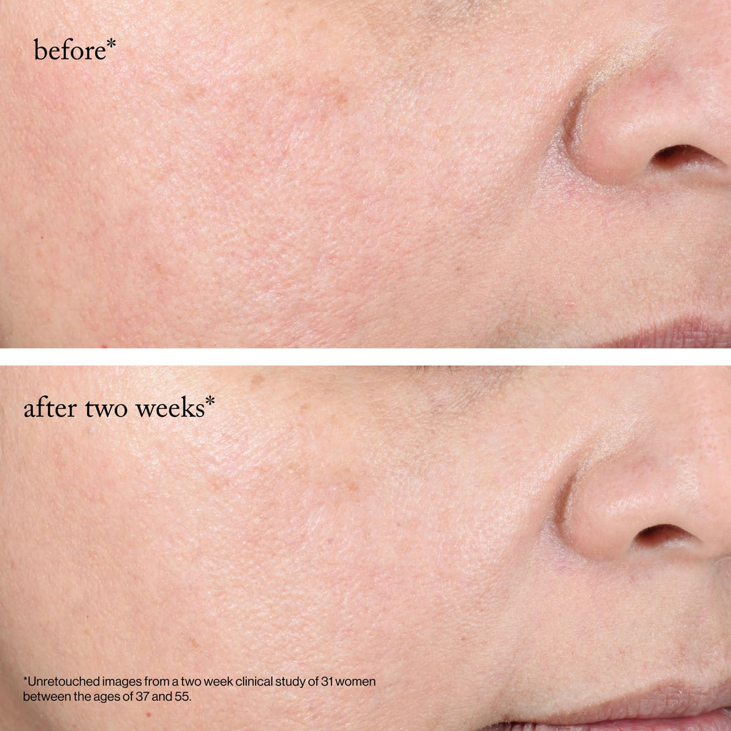 Goop 15% glycolic acid facial treatment lifestyle aesthetic shot