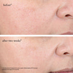 Goop 15% glycolic acid facial treatment lifestyle aesthetic shot