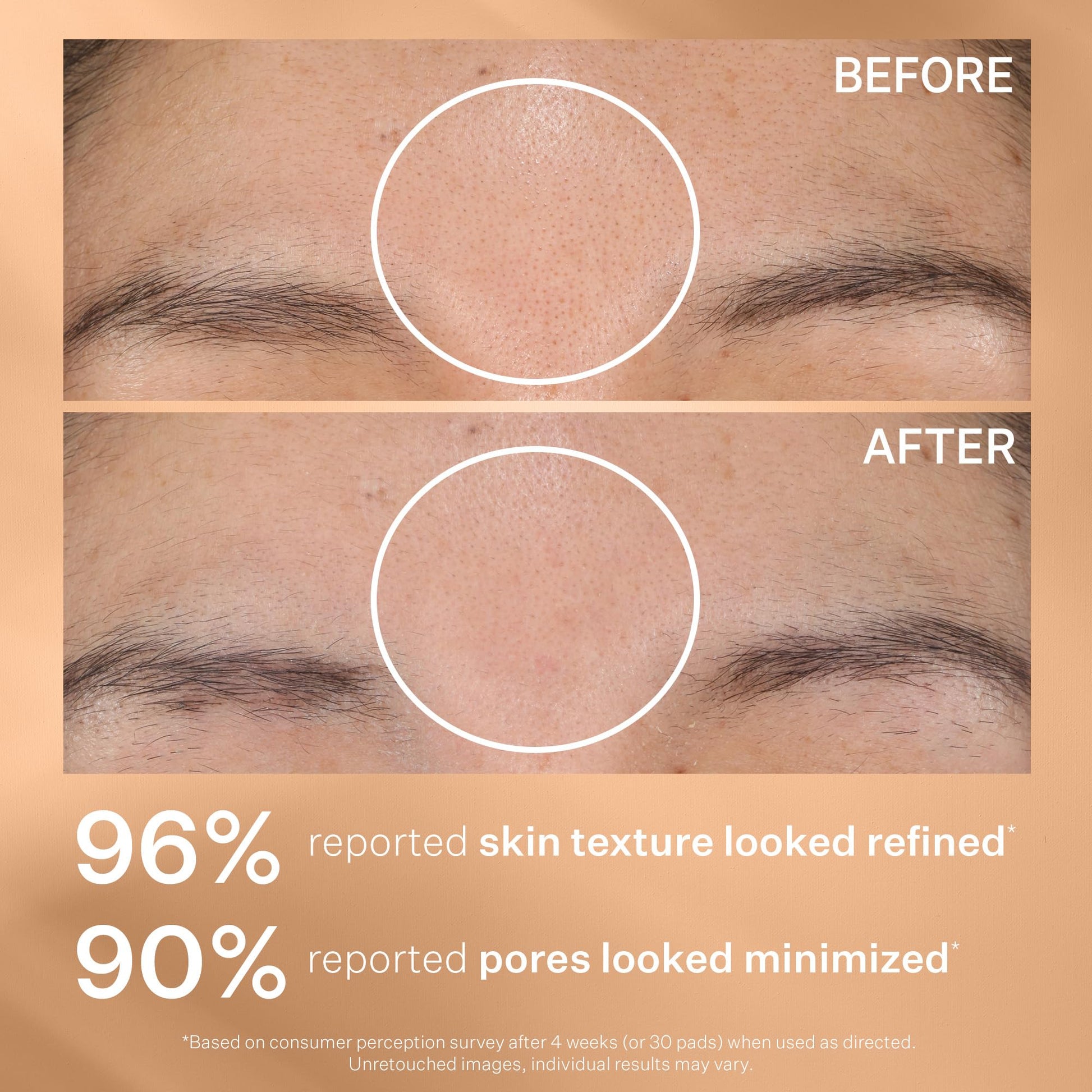 Authentic USA imported StriVectin skin brightening peel pads