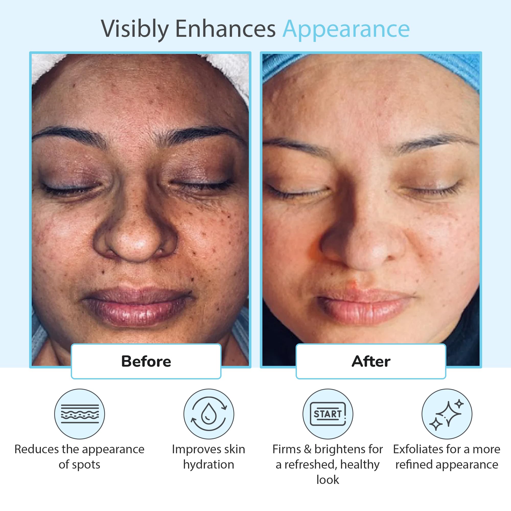 Perfect Image Glycolic Acid professional skin peel application directions on back label