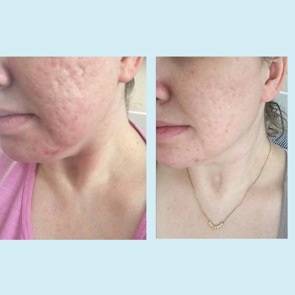 Perfect Image Glycolic Acid 50 Percent Gel Peel ingredient overview