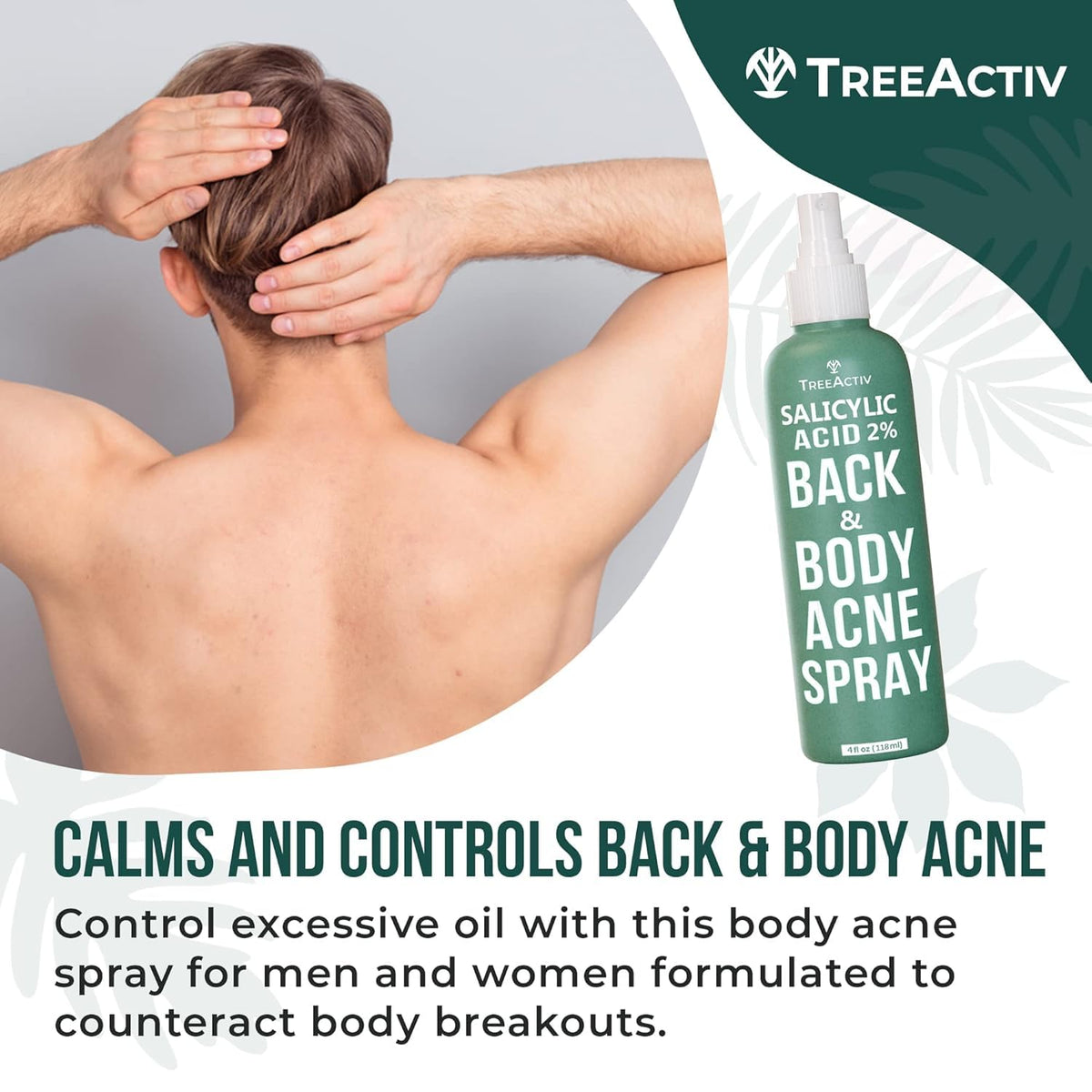 TreeActiv skincare product box packaging with two fluid ounce bottles