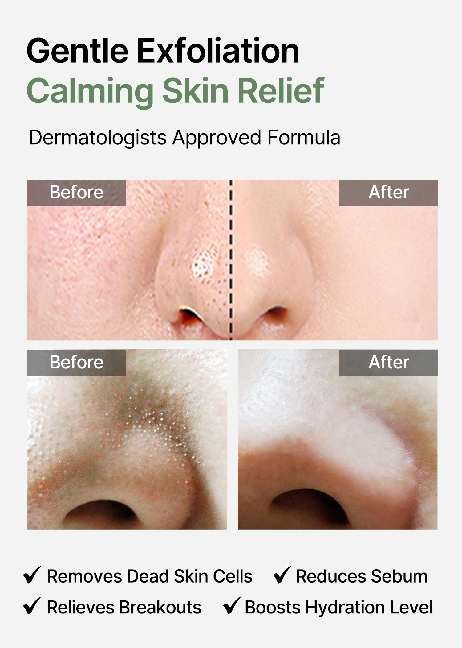Celimax Korean peeling pad highlighting the gauze side texture used for intense nose and neck exfoliation.