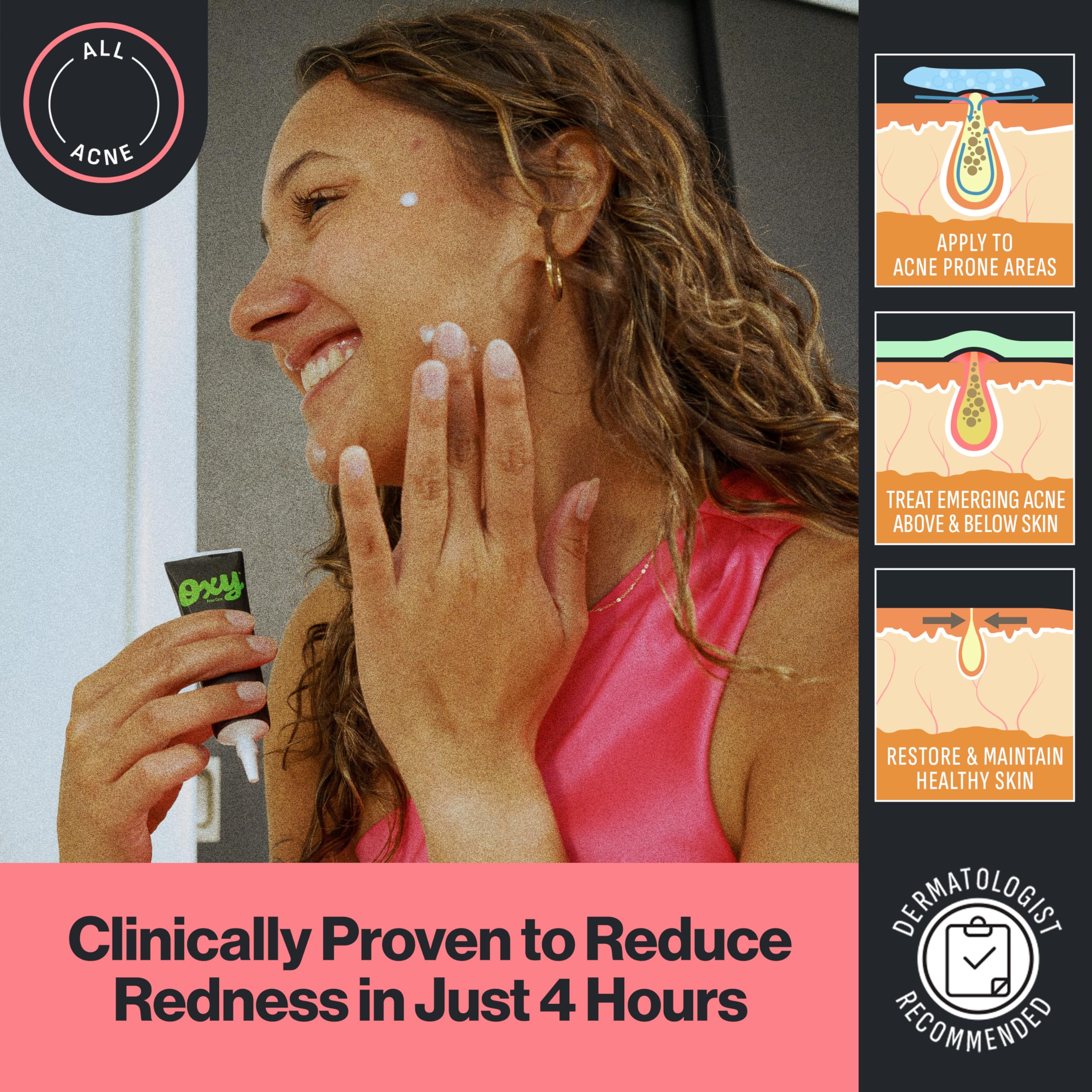 Oxy 10 percent benzoyl peroxide spot medication for blackheads and redness reduction.