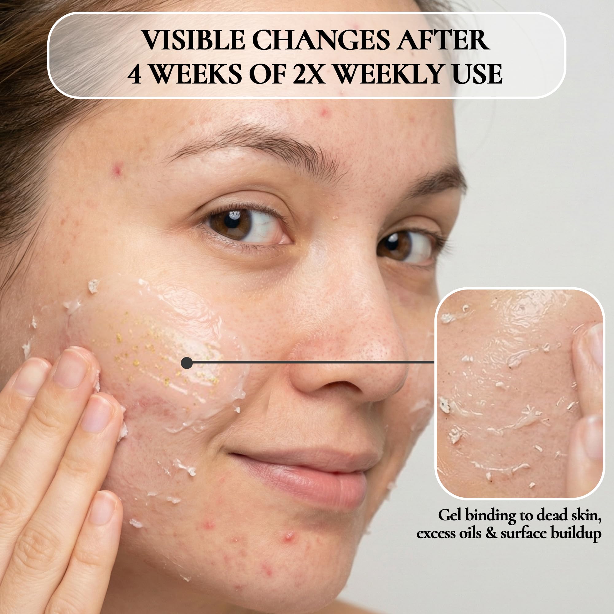Gommage style face peel gel by Vivo Per Lei for gentle exfoliation