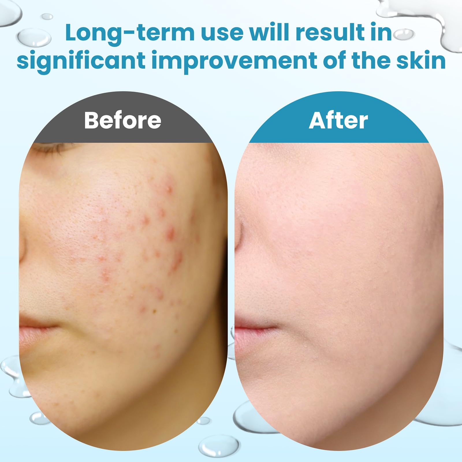Dalin anti aging resurfacing face pads container showcasing active ingredients.
