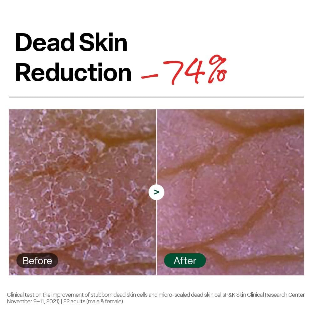Dr. G brightening gel exfoliant for clearing blackheads and dead skin