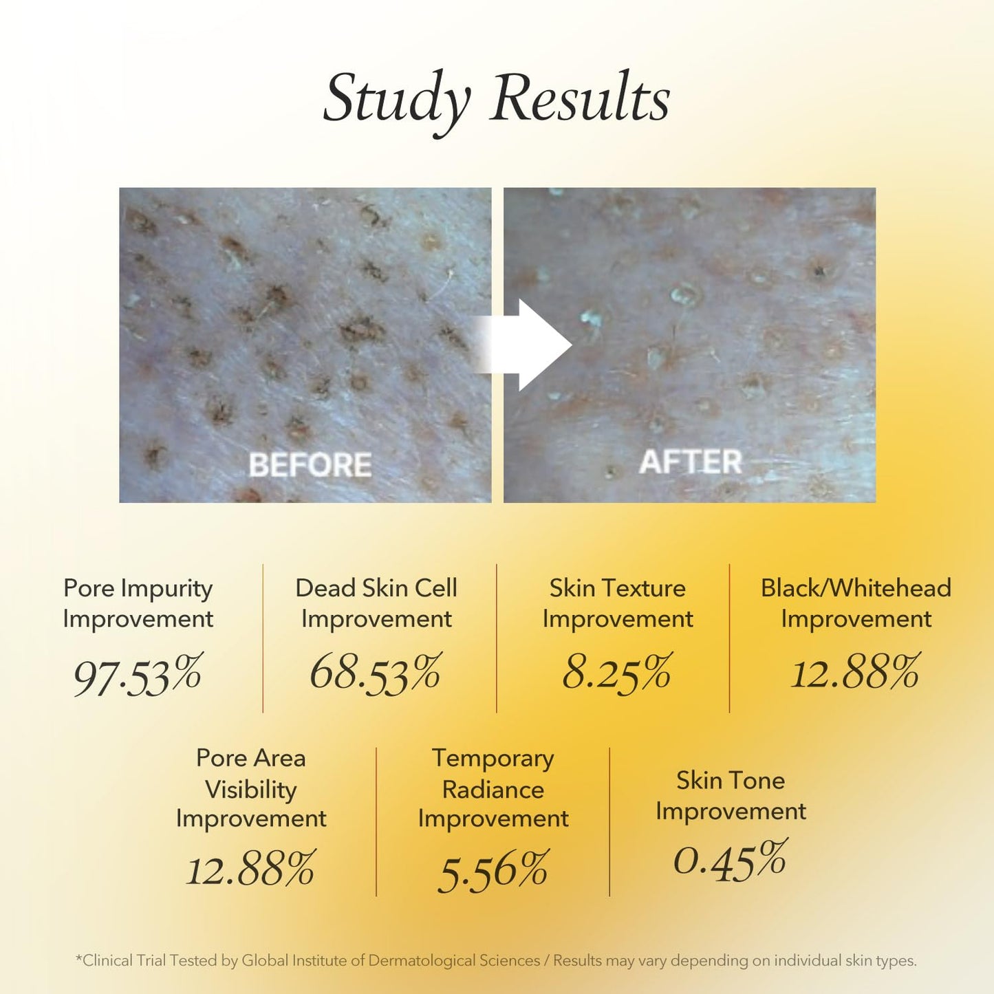 APRILSKIN real calendula face pack for sensitive skin care