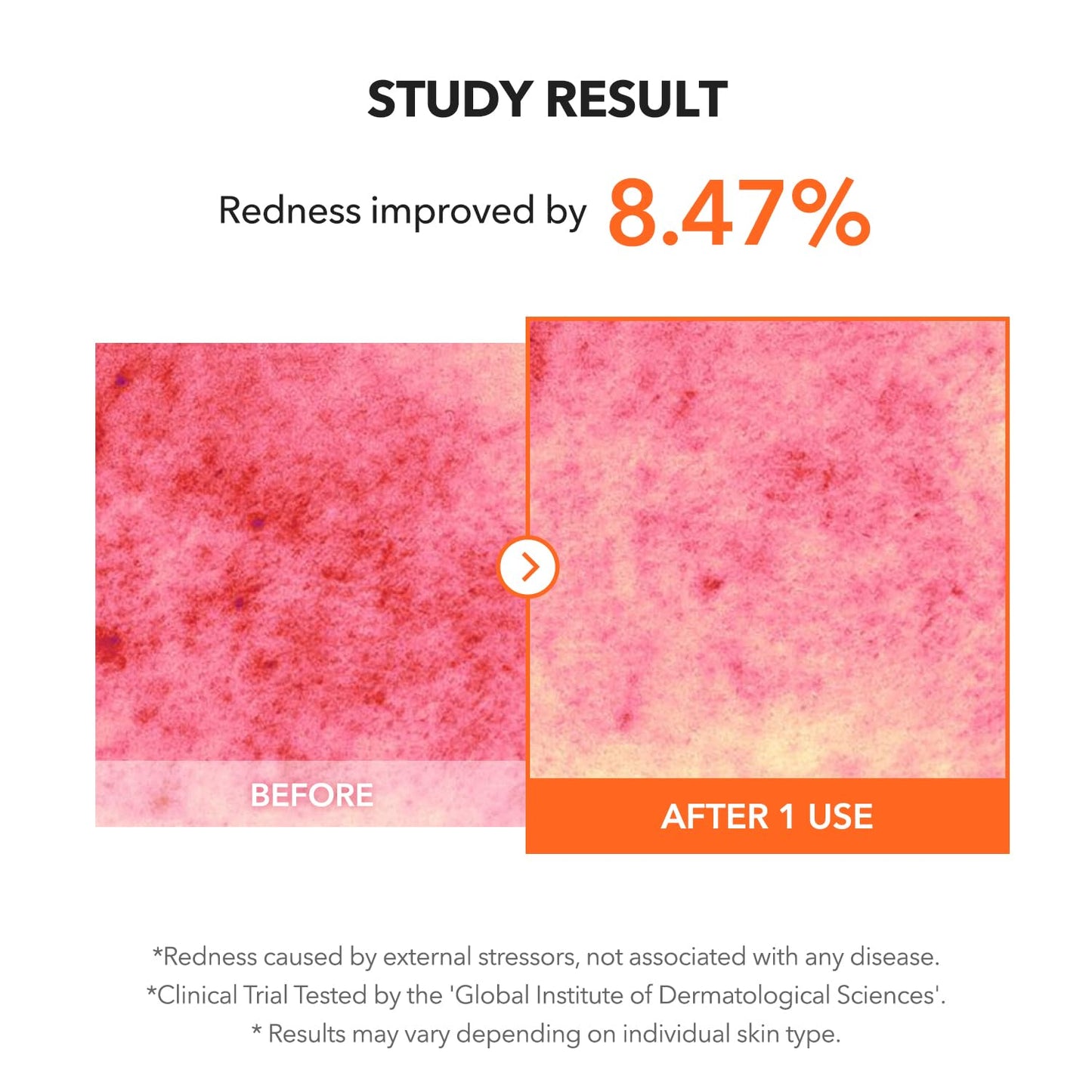Imported APRILSKIN Carrotene IPMP clearing gel cream travel friendly bottle